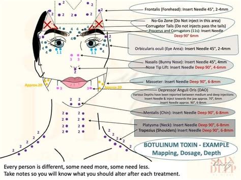 Image result for Botox Injection Patterns