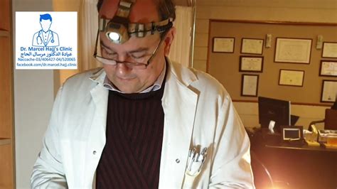 Image result for Abscessed Cysts Exploding