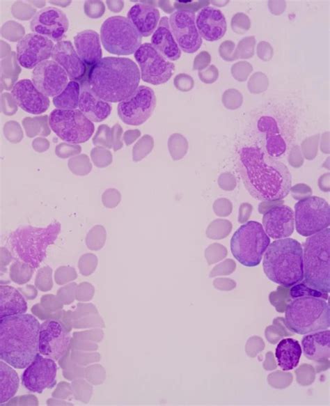 Image result for Cytotoxicity Testing