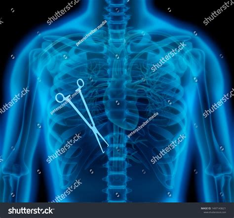 Image result for Medical Error Icon