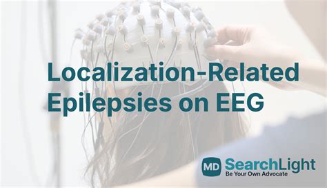 Image result for EEG Source Localization