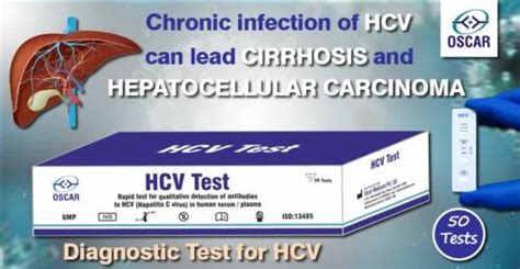 Rapid Test Kits - CTK Trustline Torch Panel Rapid Test Manufacturer ...