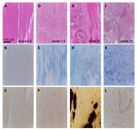 Intraarticular Ligament Degeneration Is Interrelated with Cartilage and ...