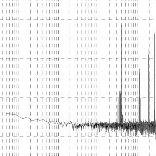 Image result for PWM Output