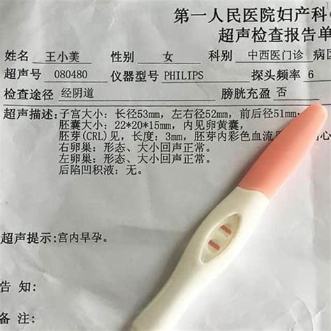 北京妇产医院产科产检攻略：产检时间表及项目2022 - 知乎
