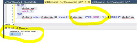 Image result for Master SQL Select