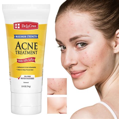 De La Cruz Sulfur Acne Treatment-Sulfur Acne Treatment,Sulfur Ointment ...
