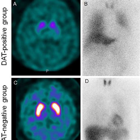 Image result for Dat Positive