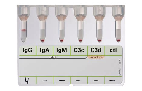 Image result for Polyspecific Dat