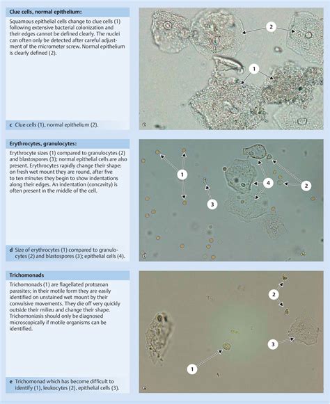 [PDF] Diagnostic Value of Vaginal Discharge, Wet Mount and Vaginal pH ...