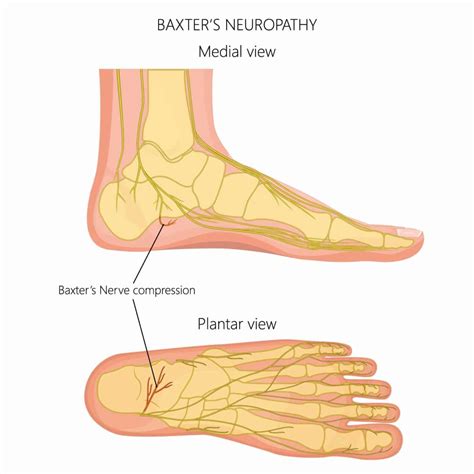 Pain in Middle of the Foot [Causes, Symptoms and Best Treatment]