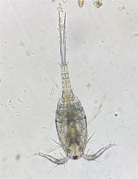 Pond Water Under Microscope