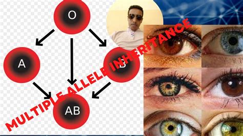 Image result for Inheritance Allele