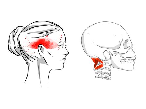 Back Of Head Muscles
