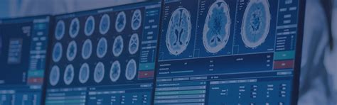 Intraoperative Nerve Monitoring | IBS Hospital