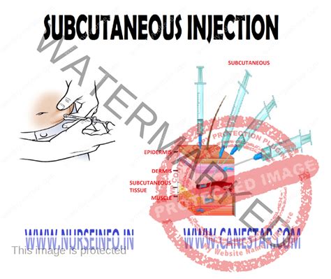 Deep Subcutaneous Injection 的图像结果