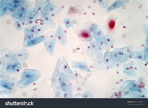 Cheek Cells Under Microscope 100x