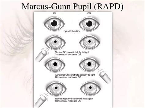 PUPIL - ANATOMY, PHYSIOLOGY AND REFLEXES | PPTX