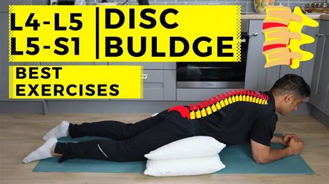 Image result for L5 Bulging Disc Exercises