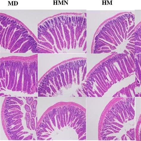 Image result for Duodenum vs Jejunum