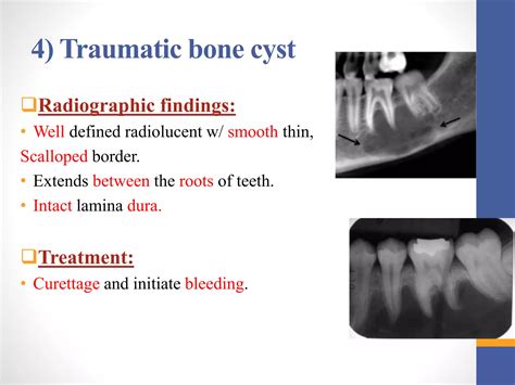 Cysts and tumors in pediatric dentistry | PPTX