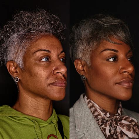 Image result for Thread Removal