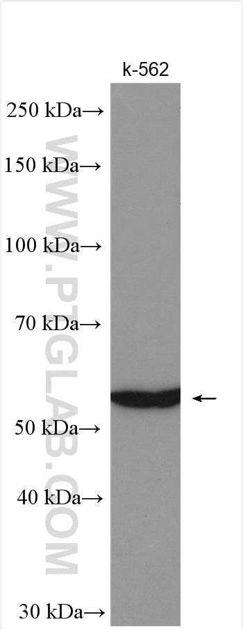 IL-17RB antibody (20673-1-AP) | Proteintech