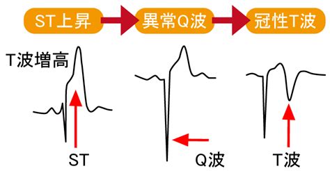 Image result for Simple Process of Text Analytics