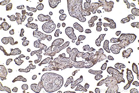 IHCeasy CALR Ready-To-Use IHC Kit KHC2215 | Proteintech
