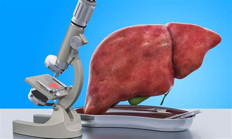 Rifaximin and lactulose combo effectively, decreases mortality in ...