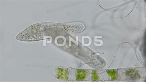 Paramecium Caudatum Under Microscope