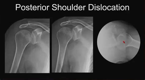Strategic Radiology | Things That Go Bump in the Night: Tricky MSK Trauma