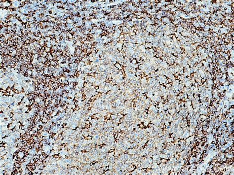 NOX2 antibody (19013-1-AP) | Proteintech