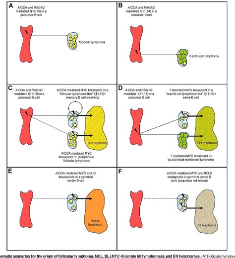 Figure 1 from Double-hit B-cell lymphomas. | Semantic Scholar