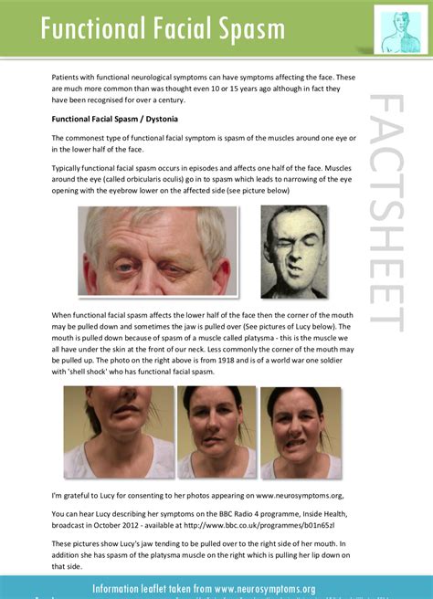 Functional Facial Symptoms – Functional Neurological Disorder (FND)