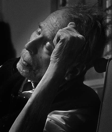 Lupus Eyes - The Lupus Encyclopedia