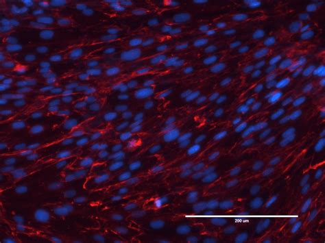 Image result for Measuring Fluorescence Intensity ImageJ