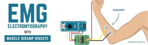 Muscle BioAmp BisCute | World's Most Affordable DIY Muscle Sensor (EMG ...