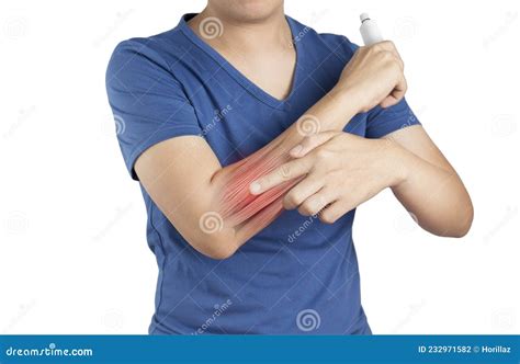 Forearm Muscle Strain Stock Image | CartoonDealer.com #47400019