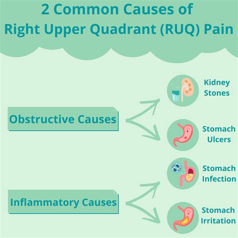 Left Upper Quadrant Pain Causes