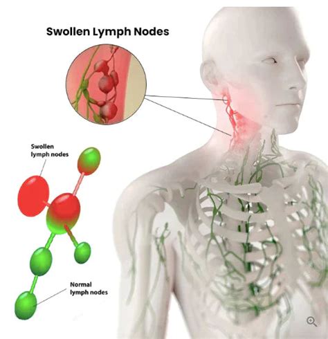 Lymphatic Drainage Herbal Shower Gel – herbamore