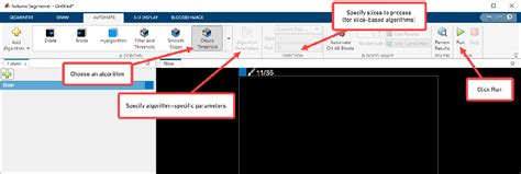 Image result for Volume Segmenter MATLAB Tutorial