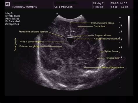 Ultrasonography | LFMC