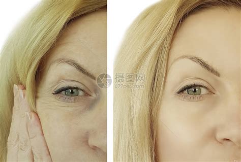 脸女人皱纹前后高清图片下载-正版图片503351138-摄图网
