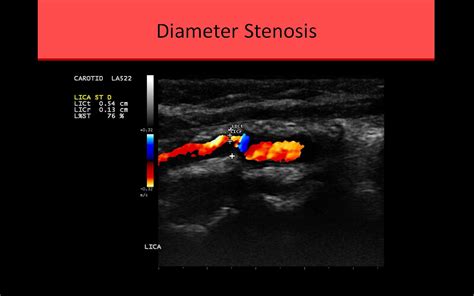 CCI Vascular Ultrasound Registry Review Course