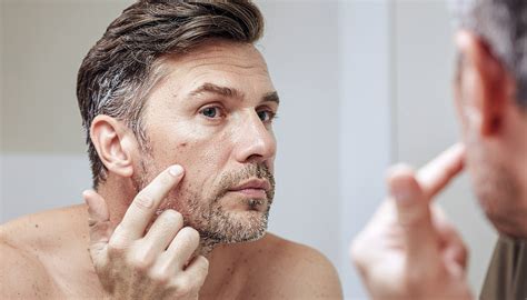 What Is iPledge? A Complete Guide to the Program Patients Must Join for ...