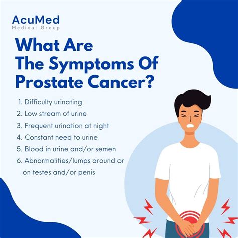 Prostate Cancer 的图像结果