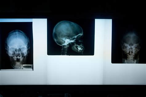 Medical Imaging Programs | Hagerstown Community College