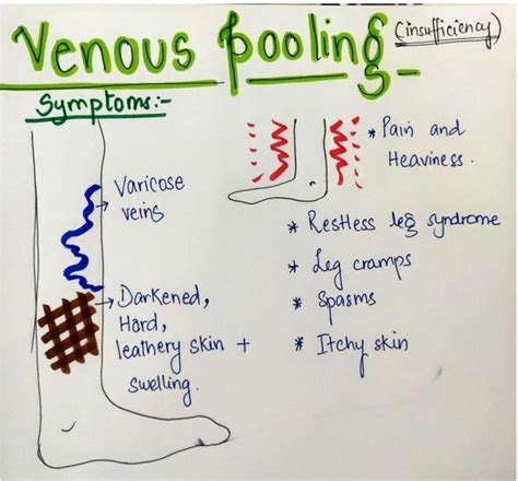 Venous Pooling (Chronic Venous Insufficiency) - Symptoms, Causes & Treatment