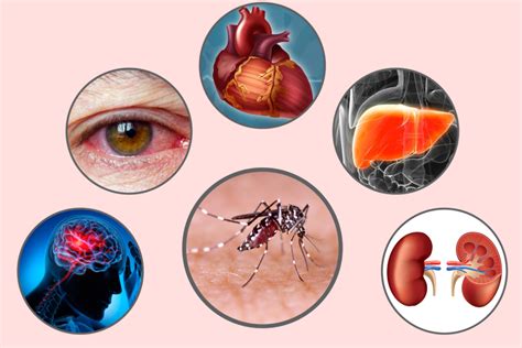 Must Read! Health complications due to Chikungunya Virus – The Health Quest